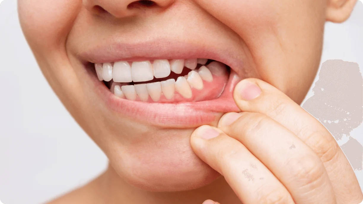 Unclear dental image