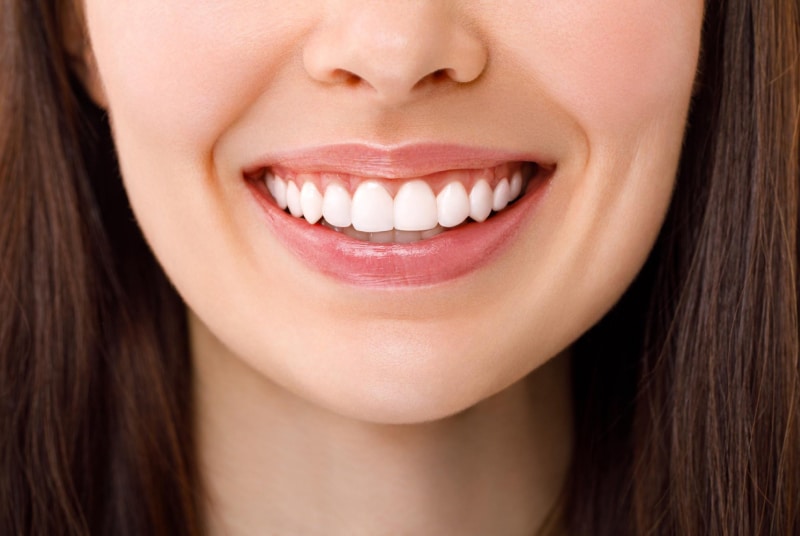 beautiful-woman-is-smiling-smile-with-white-teeth-close-up-image 1