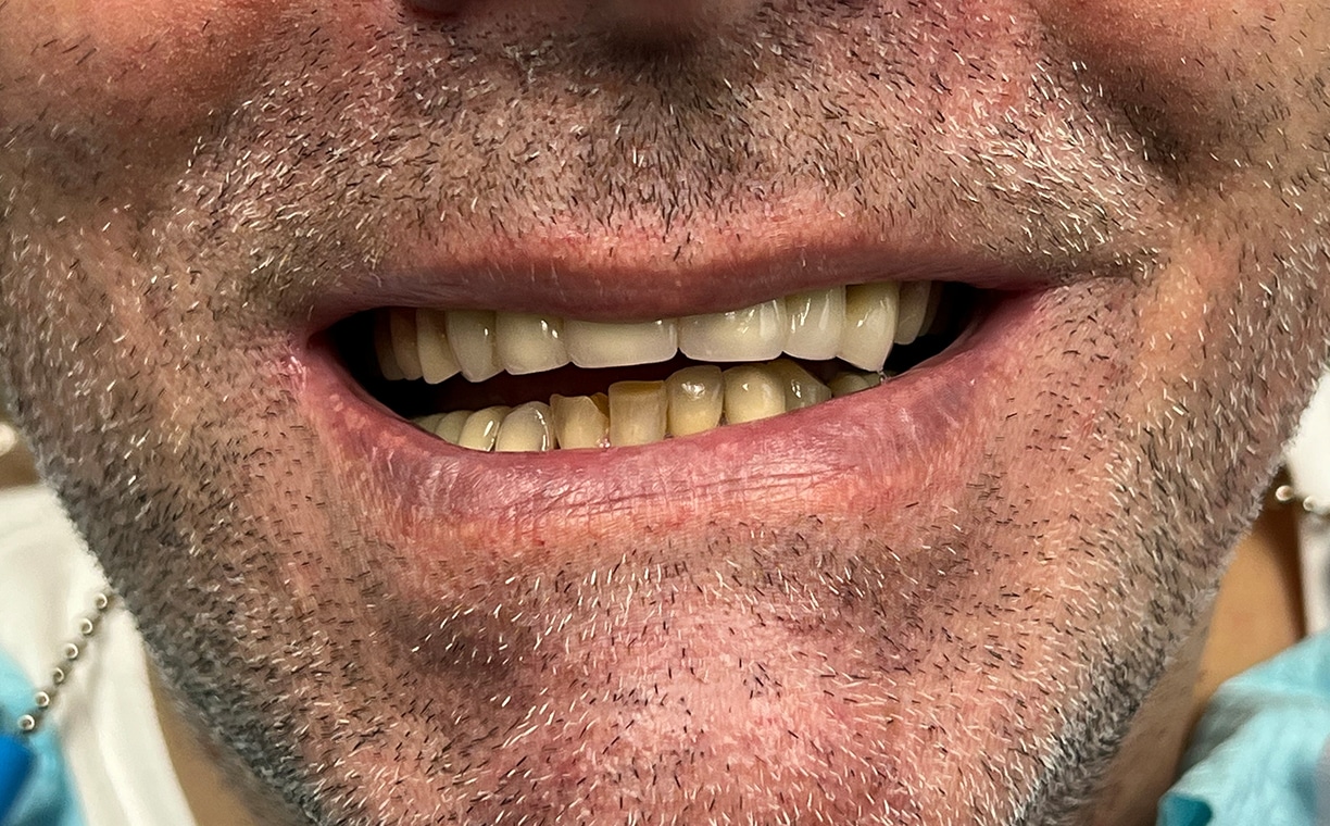 Patient testimonial of Teeth alignment