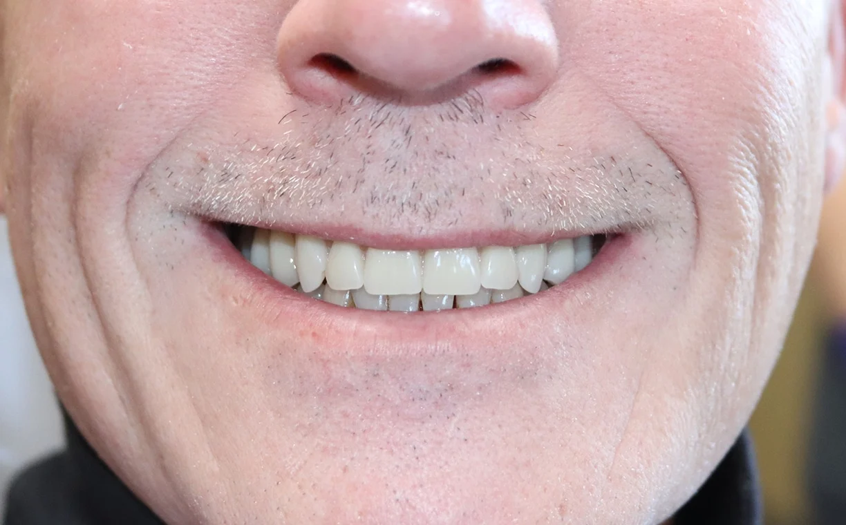 Before' dental treatment