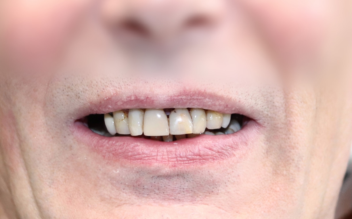dental treatment results