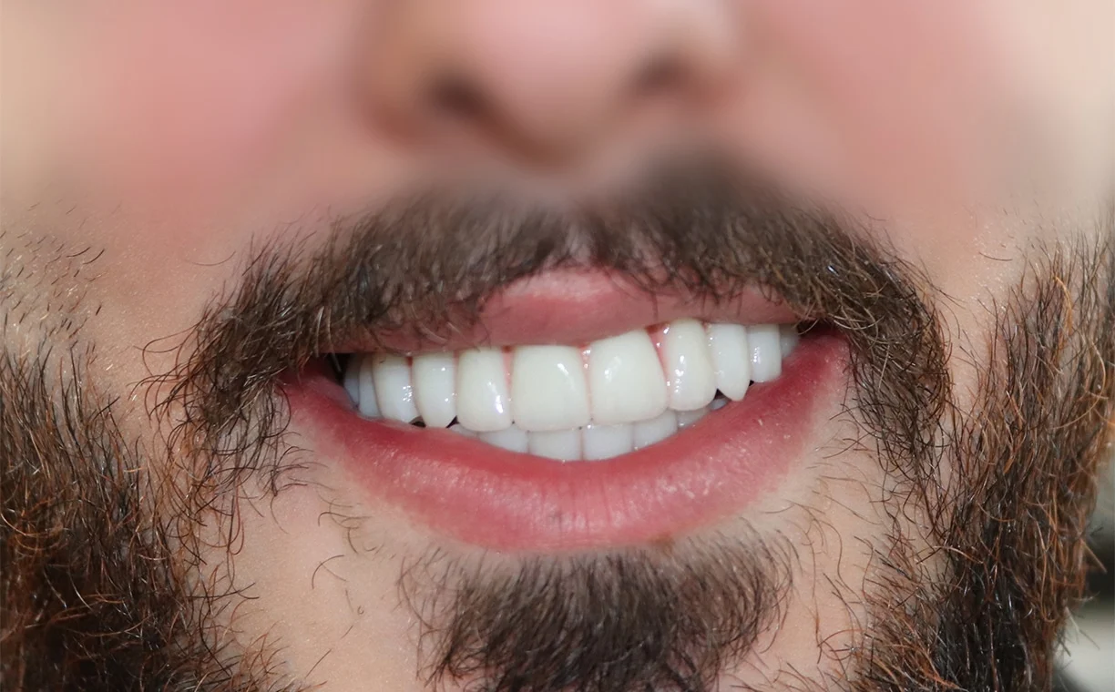 After' dental treatment