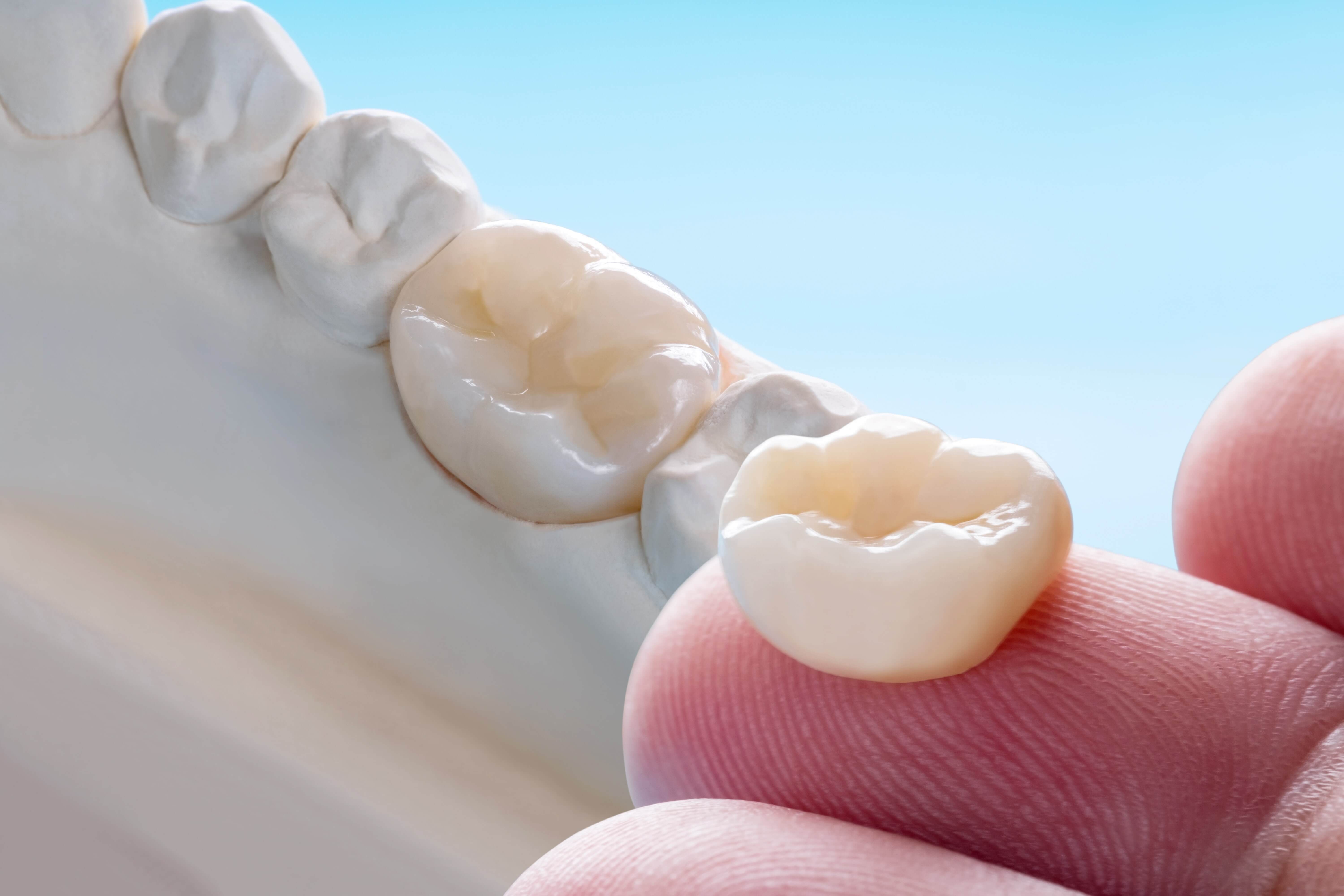 closeup-prosthodontics-prosthetic-single-teeth-crown-bridge-equipment-model-express-fix-restoration (1)-min (1)