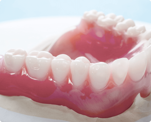 removable-partial-denture-medically-accurate-toothgenerative-ai 1 (2) (1)