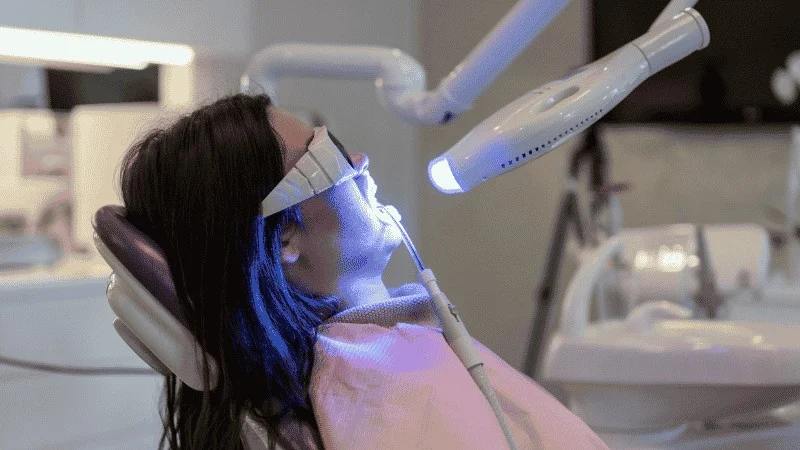 professional teeth whitening vs at home