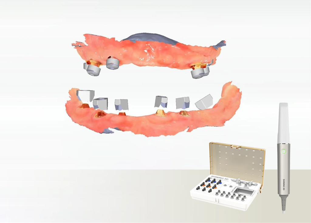 Intraoral Photogrammetry (IPG)